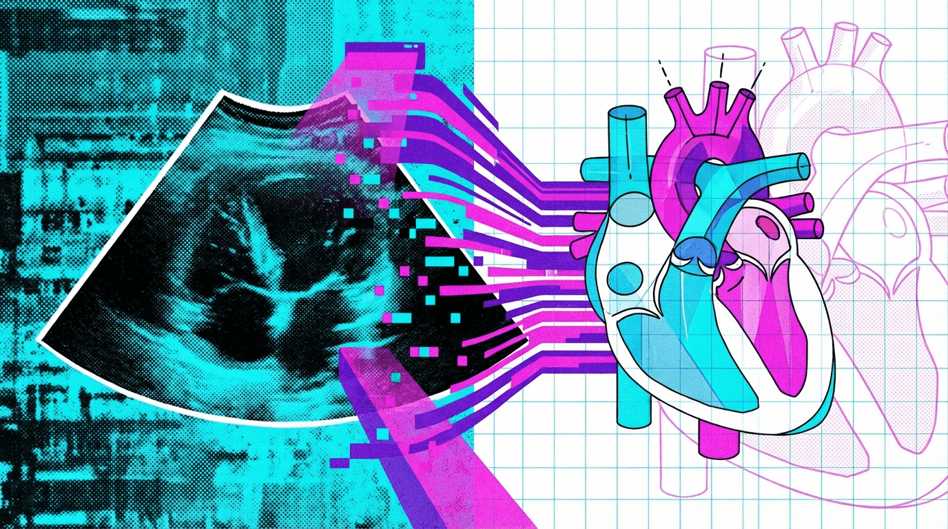 Meta's JEPA: The Unexpected MVP in Cardiac Ultrasound