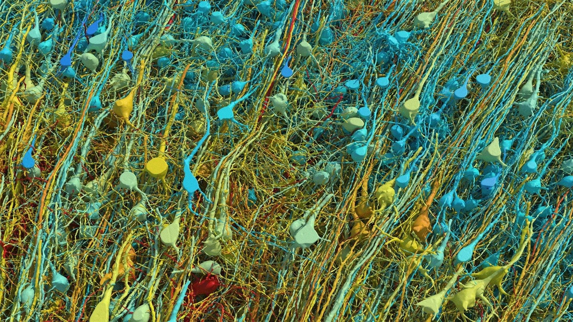 The Human Brain: Still the Only True General Intelligence