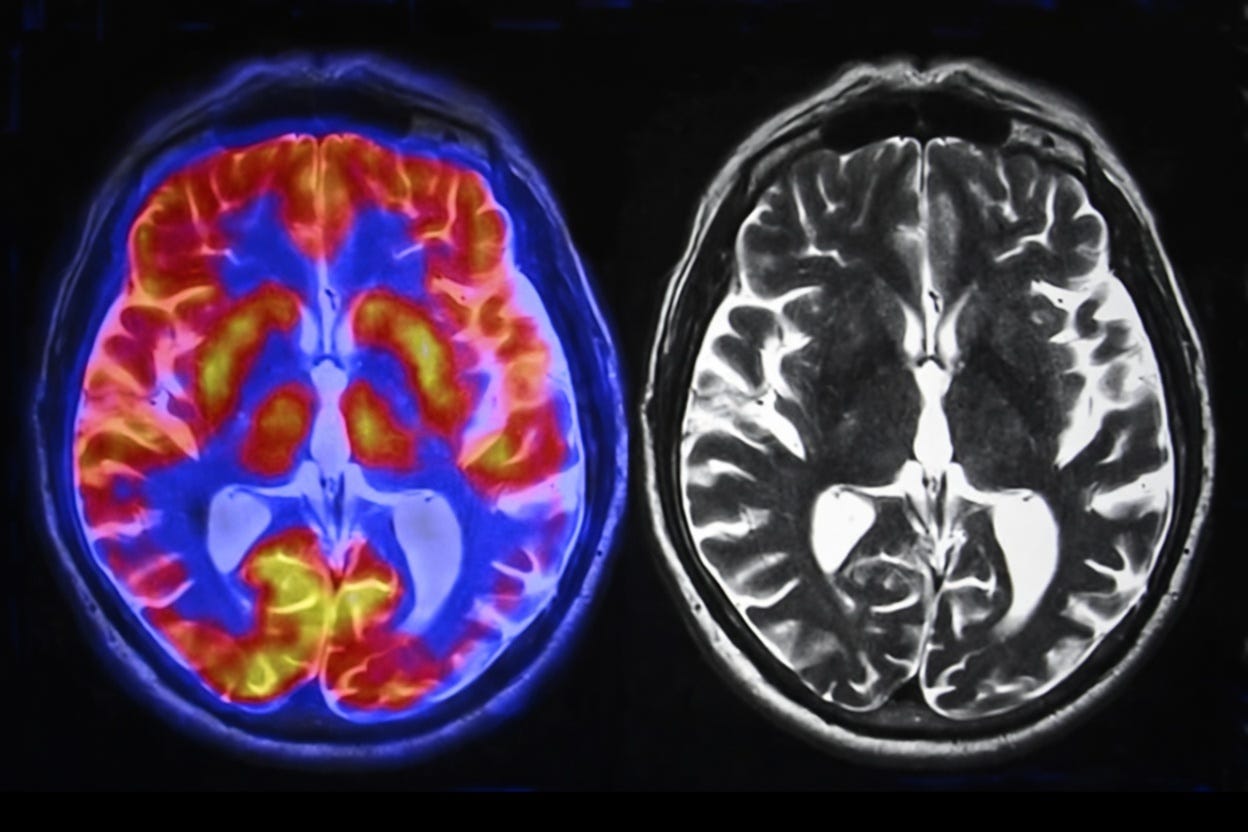AI and Your Brain: A Love-Hate Relationship